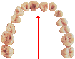 photo of the upper teeth of a Homo erectus with the shovel-shaped incisors highlighted